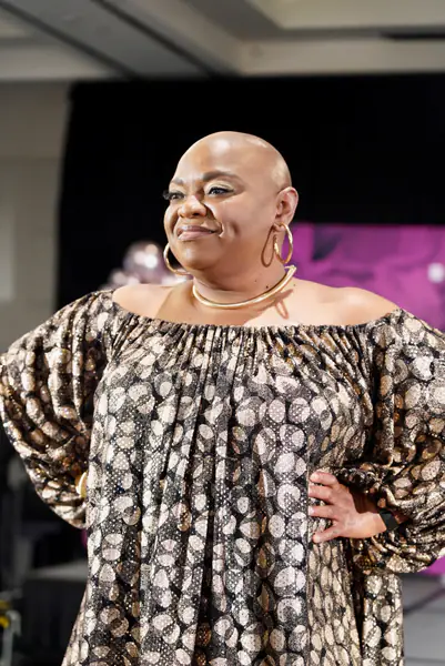 A bald model poses with hands on hips in a gold collar necklace, large hoop earrings and a shimmering gold and black off-the-shoulder top.